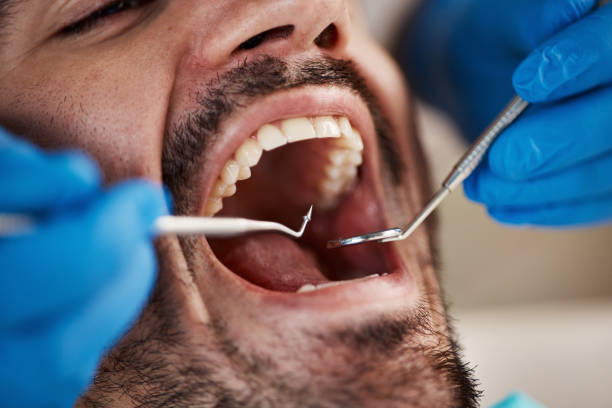 Best Emergency Denture Repair in Port Townsend, WA